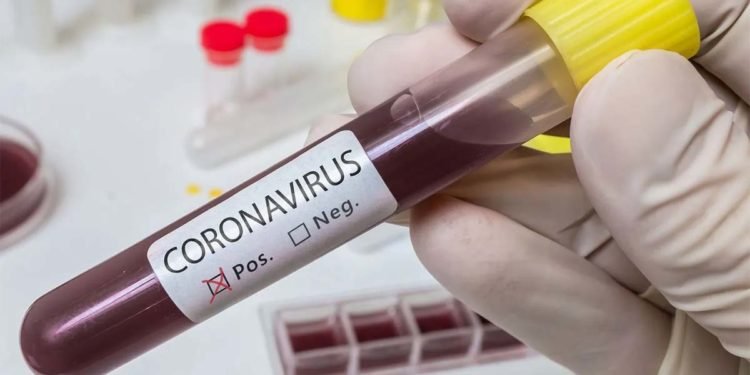 GENERAL MADARIAGA: Echeverría: “Hay un caso positivo, cuatro sospechosos y 22 contactos aislados”