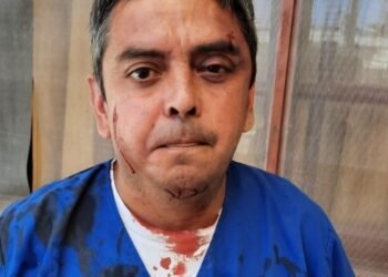 GENERAL LAVALLE: Agredieron al secretario de salud Marcelo Cachagua y le ocasionaron lesiones