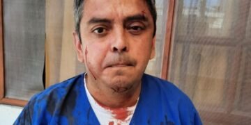 GENERAL LAVALLE: Agredieron al secretario de salud Marcelo Cachagua y le ocasionaron lesiones